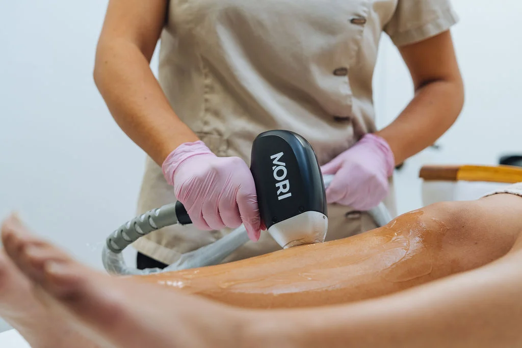 Laserontharing behandeling bij Gloow